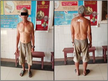 ကရင်ပြည်နယ်၊ ကော့ကရိတ်မြို့နယ်၌ လက်နက်ကိုင်အကြမ်းဖက်သမားများက ရပ်ကွက်အတွင်း လက်နက်ကြီးများဖြင့် ပစ်ခတ်တိုက်ခိုက်မှုကြောင့် အပြစ်မဲ့ အရပ်သားပြည်သူ တစ်ဦး ထိခိုက်ဒဏ်ရာရရှိမှု မှတ်တမ်းဓာတ်ပုံ။