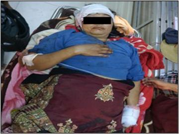 A novice and two innocent civilians sustained shrapnel injuries after armed terrorists launched heavy weapon attacks on villages in Sagaing Township of Sagaing Region.
