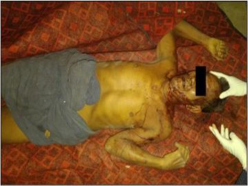 Innocent Civilian Killed by Terrorists in Ngazun Township of Mandalay Region