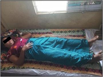 Civil Servant and a Child Injured in Improvised Rocket Attack by Terrorists  in Salin Township of Magway Region.