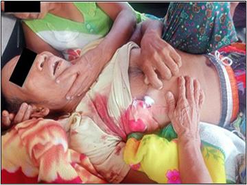 Innocent Civilian Killed in Heavy Weapon Attack by Terrorists in Yebyu Township of Tanintharyi Region.