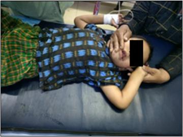Child Injured in Heavy Weapon Attack by Terrorists in Myinmu Township of Sagaing Region