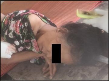 Innocent Civilian Killed in Drone Bomb Attack by Terrorists in Kyauktaga Township of Bago Region.