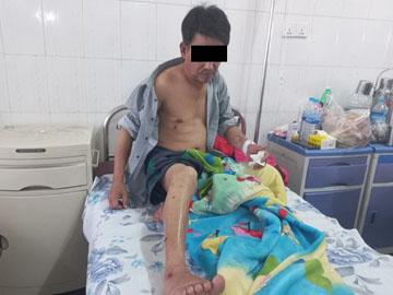 Innocent Civilian Injured in Explosion of IED by Terrorist Faction in Myitkyina Township of Kachin State.