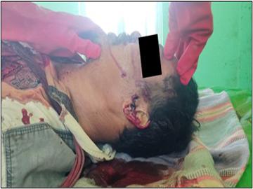 မကွေးတိုင်းဒေသကြီး၊ အောင်လံမြို့နယ်၌ လက်နက်ကိုင်အကြမ်းဖက်သမားများက အပြစ်မဲ့ အရပ်သားပြည်သူ တစ်ဦးအား အကြောင်းမဲ့ လုပ်ကြံသတ်ဖြတ်