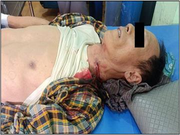 A man shot dead in Wunzin Ward, Meiktila Township of Mandalay Region.