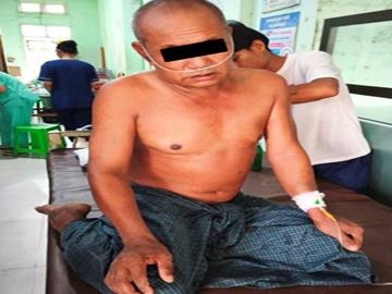Innocent Civilian Sustains Gunshot Wounds in Attack by So-Called PDF Terrorists in Shwebo Township of Sagaing Region