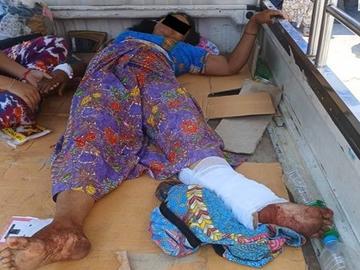 စစ်ကိုင်းတိုင်းဒေသကြီး၊ စစ်ကိုင်းမြို့နယ်၌ PDF အမည်ခံ အကြမ်းဖက်သမားများက လုပ်ကြံသတ်ဖြတ်မှုကြောင့် အပြစ်မဲ့ အရပ်သားပြည်သူ တစ်ဦး ထိခိုက်ဒဏ်ရာရရှိမှု မှတ်တမ်းဓာတ်ပုံ။