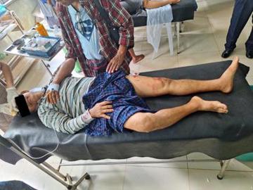 Four innocent civilians were injured and a vehicle was damaged by an explosive device planted by pro-terrorism KUN members and so-called PDF terrorists on the roadside of the Yangon-Mawlamyine Road in Kyaikto Township of Mon State.
