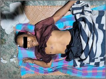 ပဲခူးတိုင်းဒေသကြီး၊ ကြို့ပင်ကောက်မြို့နယ်၌ PDF အမည်ခံ အကြမ်းဖက်သမားများက လုပ်ကြံသတ်ဖြတ်မှုကြောင့် အပြစ်မဲ့ အရပ်သားပြည်သူ တစ်ဦး သေဆုံး