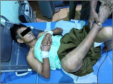 100-household elder was injured in an attack by so-called PDF terrorists in Pyawbwe Township of Mandalay Region.