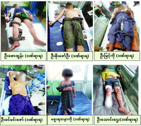 မန္တလေးတိုင်းဒေသကြီး၊ မတ္တရာမြို့နယ်အတွင်း PDF အမည်ခံအကြမ်းဖက်သမားများက လက်နက်ကြီးများဖြင့် ကျေးရွာအတွင်း အကြောင်းမဲ့ပစ်ခတ်ခြင်း၊ မိုင်းထောင်ခြင်းများကြောင့် ကလေးငယ် ၁ ဦးအပါအဝင် အပြစ်မဲ့ပြည်သူ ၆ ဦး ထိခိုက်ဒဏ်ရာရရှိ