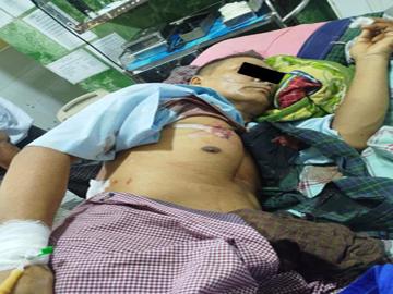A 100-household elder was injured in an attack by so-called PDF terrorists in Pyin Chaug Village, Taungdwingyi Township of Magway Region.