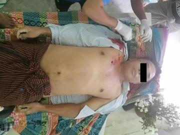 An innocent civilian was shot dead by so-called PDF terrorists in Nyaung-U Township of Mandalay Region.