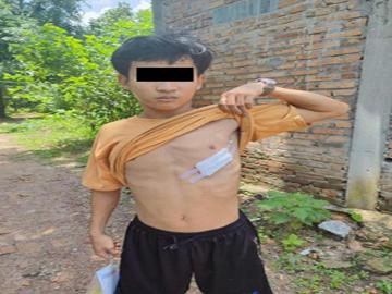 ကရင်ပြည်နယ်၊ ကော့ကရိတ်မြို့နယ်၌ အကြမ်းဖက်အဖွဲ့(စိစစ်ဆဲ)က ကျေးရွာအတွင်းသို့ ရှော့တိုက်ဒုံး များဖြင့် ပစ်ခတ်တိုက်ခိုက်ခဲ့မှုကြောင့် အပြစ်မဲ့ အရပ်သားပြည်သူ တစ်ဦး ထိခိုက်ဒဏ်ရာရရှိမှု မှတ်တမ်းဓာတ်ပုံ။