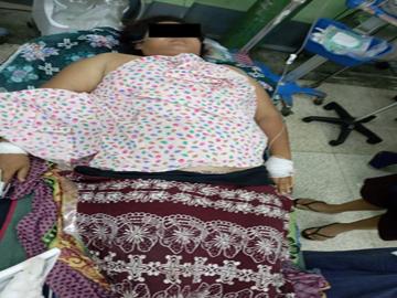Innocent Civilian Injured in Attack by So-Called PDF Terrorists in Pakokku Township of Magway Region