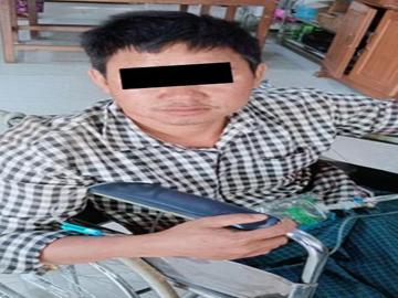 An innocent civilian injured in a heavy weapon attack by TNLA terrorist group in Naungcho Township of Northern Shan State.