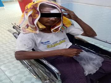 Innocent Civilian Injured After Explosion Device Planted by So-Called PDF Terrorist Group in Yaenanchaung Township of Magway Region