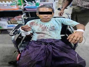 Two innocent civilians were injured in a heavy weapon attack by a so-called PDF terrorist group in Ngazun Township, Mandalay Region.