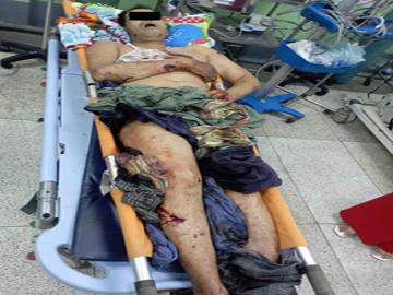 Innocent Civilian Killed in Heavy Weapon Attack by So-Called PDF Terrorist Group in Patheingyi Township of Mandalay Region
