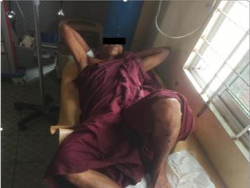 A monk injured after stepping on an explosive device planted by a so-called PDF terrorist group in Salin Township of Magway Region.