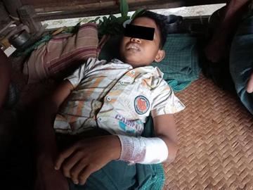 မကွေးတိုင်းဒေသကြီး၊ ပေါက်မြို့နယ်၌ PDF အမည်ခံ အကြမ်းဖက်အဖွဲ့ ထောင်ထားသည့် နင်းမိုင်း တစ်လုံး ပေါက်ကွဲခဲ့မှုကြောင့် အပြစ်မဲ့ အရပ်သားပြည်သူ တစ်ဦး ထိခိုက်ဒဏ်ရာရရှိမှု မှတ်တမ်းဓာတ်ပုံ။