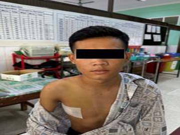 Three innocent civilians injured in heavy weapon attacks by Ta’ang National Liberation Army (TNLA) terrorist group in Kyaukme and Naungcho Townships of Shan State.
