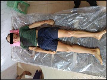 An innocent civilian shot dead by a so-called PDF terrorist group in Ye Township of Mon State.