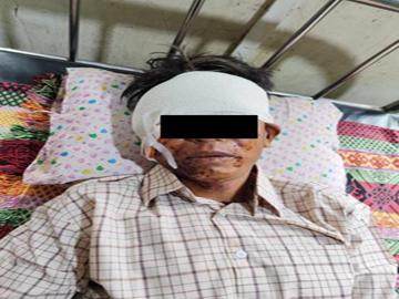 An innocent civilian was injured by explosive device planted by a so-called  PDF terrorist group in Phyu Township of Bago Region.