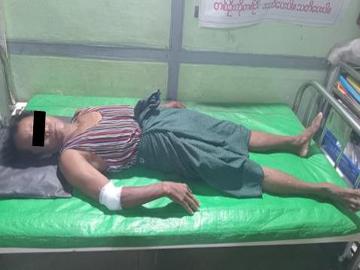 မန္တလေးတိုင်းဒေသကြီး၊ တောင်သာမြို့နယ်၌ PDF အမည်ခံ အကြမ်းဖက်အဖွဲ့က ရပ်ကွက်အတွင်းသို့ လက်နက်ကြီး/လက်နက်ငယ်များဖြင့် လာရောက်ပစ်ခတ်တိုက်ခိုက်ခဲ့မှုကြောင့်  အပြစ်မဲ့ အရပ်သားပြည်သူ နှစ်ဦး ထိခိုက်ဒဏ်ရာရရှိမှု မှတ်တမ်းဓာတ်ပုံ။