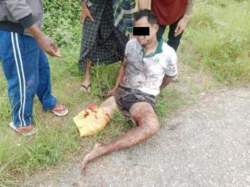 ကယားပြည်နယ်၊ လွိုင်ကော်မြို့နယ်၌ အကြမ်းဖက်အဖွဲ့(စိစစ်ဆဲ) ထောင်ထားသည့် နင်းမိုင်း တစ်လုံးအား နင်းမိပေါက်ကွဲခဲ့မှုကြောင့် အပြစ်မဲ့ အရပ်သားပြည်သူ တစ်ဦး ထိခိုက်ဒဏ်ရာရရှိမှု မှတ်တမ်းဓာတ်ပုံ။