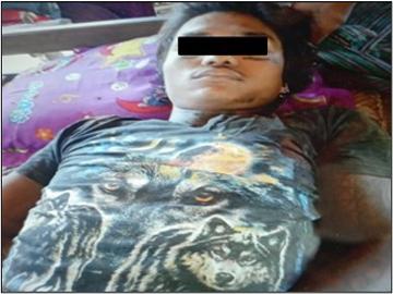 Innocent Civilian Shot Dead and Father Abducted by So-Called PDF Terrorists in Myingyan Township of Mandalay Region