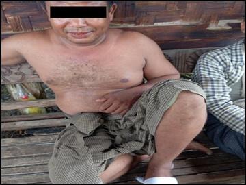  Two innocent civilians injured in an improvised rocket attack by a so-called  PDF terrorist group in Madaya Township of Mandalay Region.