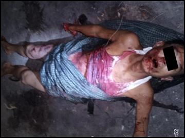 Innocent Civilian Killed in IED Attack by So-Called PDF Terrorist Group in Taungtha Township of Mandalay Region