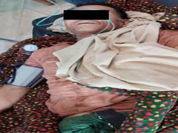 Two innocent civilians injured in heavy weapon attacks by Ta’ang National  Liberation Army (TNLA) terrorist group in Naungcho Township of Shan State.