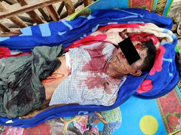 မန္တလေးတိုင်းဒေသကြီး၊ မိတ္ထီလာမြို့နယ်၌ PDF အမည်ခံ အကြမ်းဖက်သမားများက သေနတ်/ ဓားများဖြင့် ပစ်ခတ်ထိုးခုတ်ခဲ့မှုကြောင့် ကျေးရွာအုပ်ချုပ်ရေးမှူး တစ်ဦး သေဆုံး