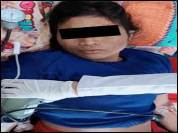 Two Innocent Civilians Injured in Heavy Weapon Attacks by Ta’ang National Liberation Army (TNLA) Terrorist Group in Naungcho Township of Northern Shan State