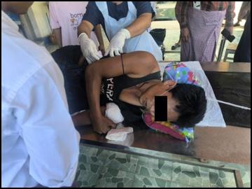 Innocent Civilian Injured in Attack by So-Called PDF Terrorist Group in Ingapu Township of Ayeyawady Region