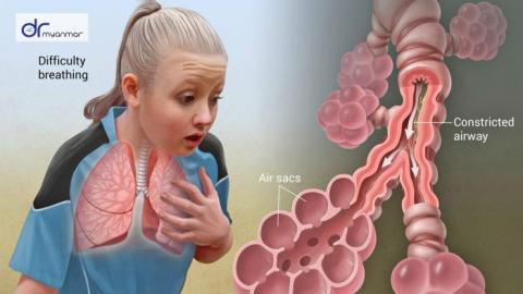 four ways to attack your aasthma